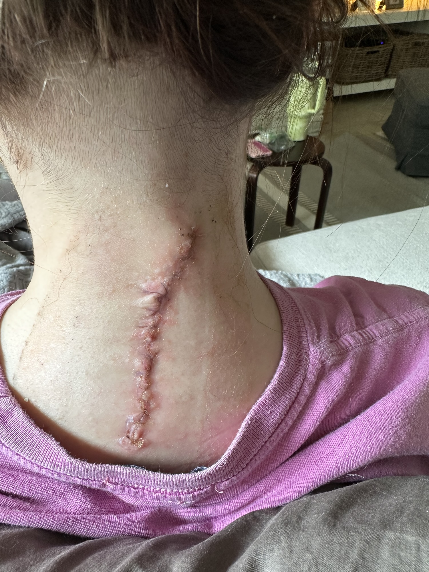 CRPS Isn’t Black and White. Stop Pretending It Is.